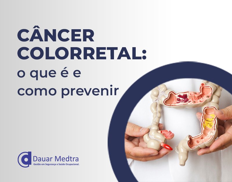 cancer colorretal